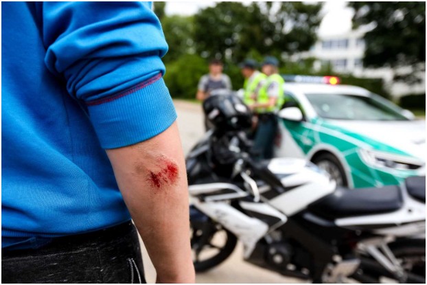 How to Help Road Rash Heal Faster