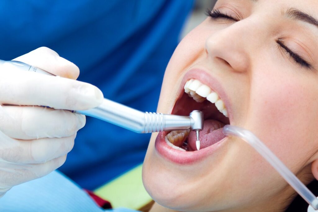 Professional Cleanings Keep Your Smile on Track