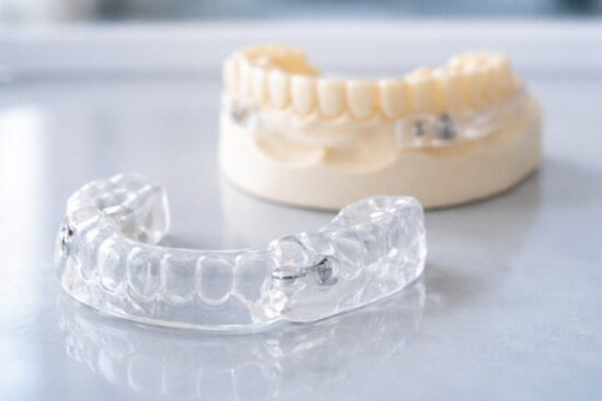 Benefits of Custom Splints for Bite Balance