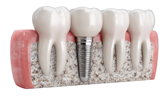 The immediate aftermath of losing a tooth